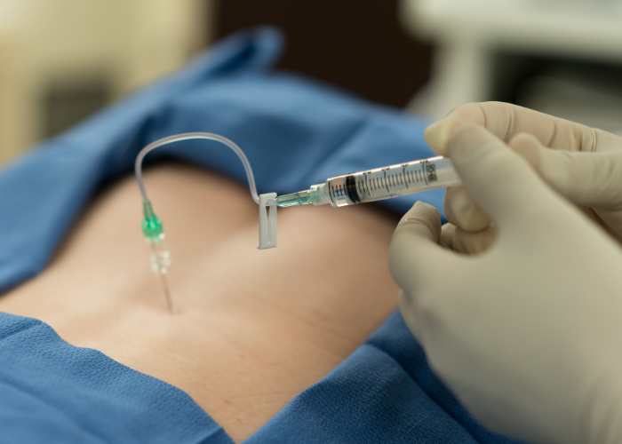 حقنة الستيرويد فوق الجافية في دبي د.محمد الطوخي