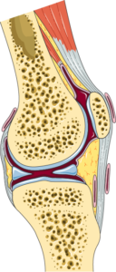 toukhy Arthritis Treatment in Dubai