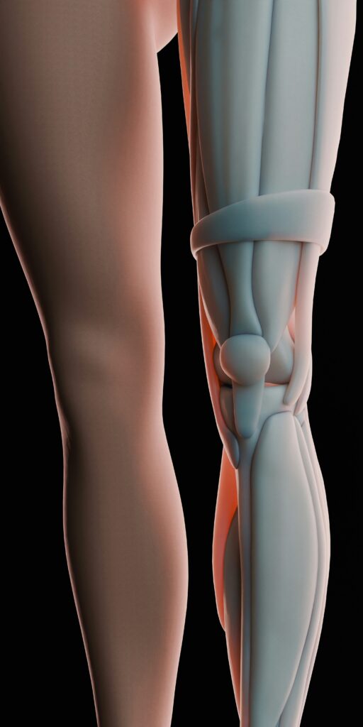 toukhy What is Osteoarthritis Causes, Symptoms, and Treatment Options