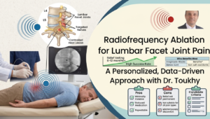 toukhy 1Radiofrequency ablation for Lumbar facet joint pain