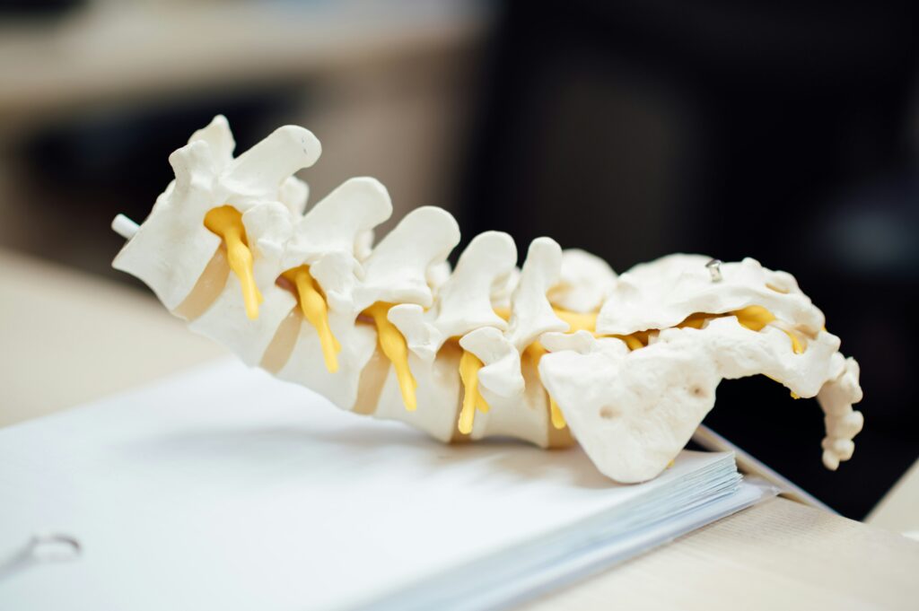 1Lumbar facet joint pain