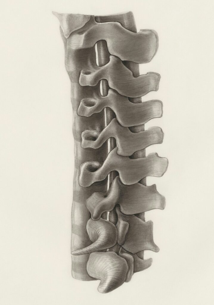 2What Is Spinal Cord Stimulation